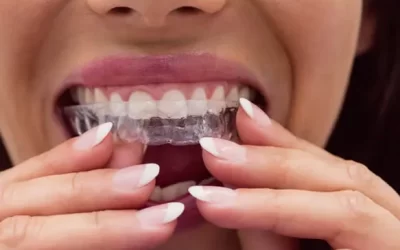 Invisalign Coral Springs: Clear Aligner Therapy for Discreet Orthodontic Correction